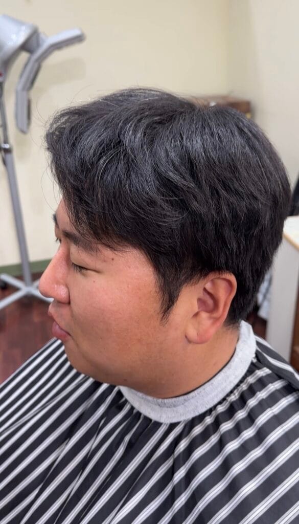드롭컷 시술전 사진