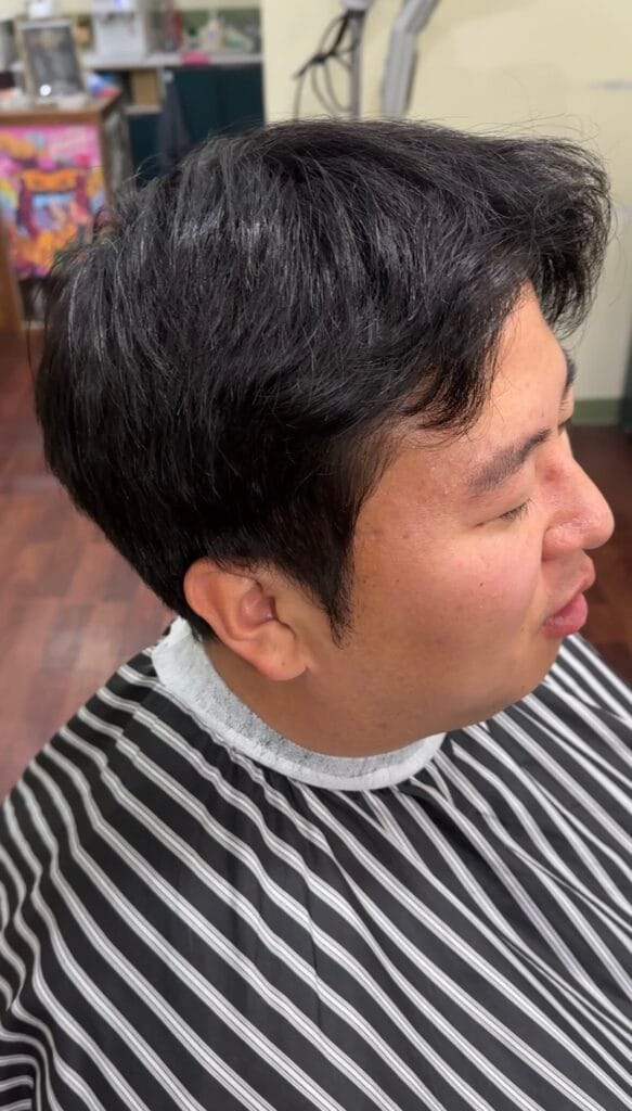 드롭컷 시술전 사진